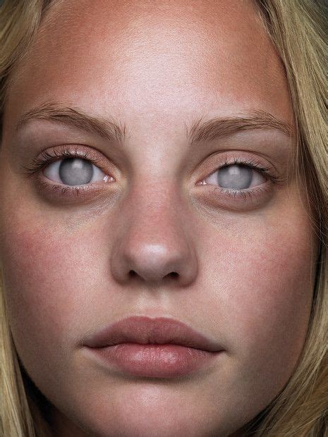 46 Blind girl ideas in 2021 | blind girl, girl, girls with glasses