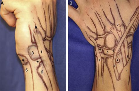 examination  ulnar sided wrist pain hand clinics
