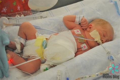 Beating All Odds {Birth Defect Awareness}