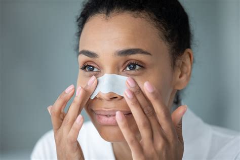 The Dermatologist's Guide To Unbelievable Blackhead Removal 2024. Image 5