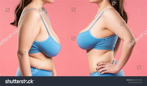 how to fix saggy breast