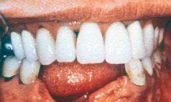 atrophic definition  atrophic