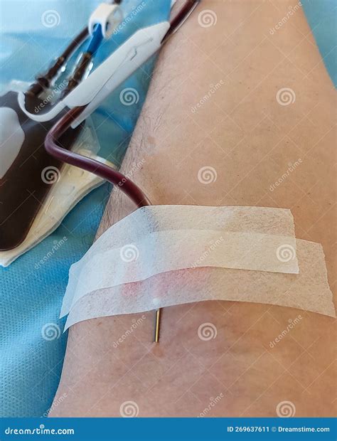 Donors are debating the blood donation needle size 15