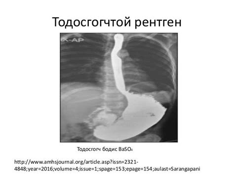 ходоодны хэт-суналт