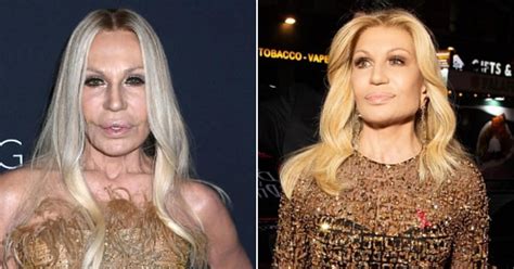 Donatella Versace Shocks Fans With Her 'New Face' At Elton John Event