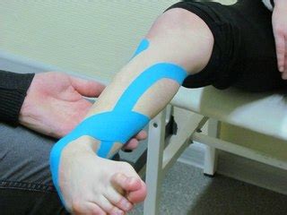 Тейпирование голеностопа при растяжении связок: как правильно клеить тейп