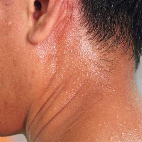 390+ Sweaty Skin Texture Stock Photos, Pictures & Royalty-Free Images ...