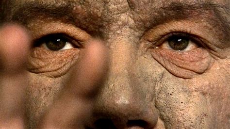 Viktor Yushchenko Recovery Ukraine's Recovery Hinges On Allied Support