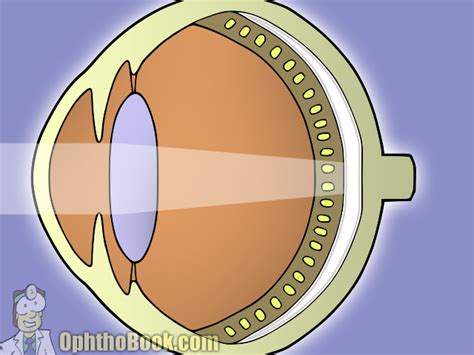 Tapetum Lucidum Diagram