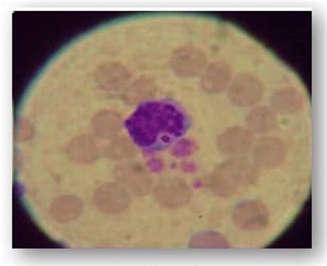 ehrlichia canis morula  monocyte cell  light microscope