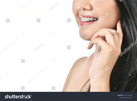 beautiful women wearing braces white isolated stock photo