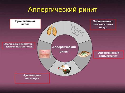 Аллергический ринит (насморк): симптомы, лечение, причины болезни ...