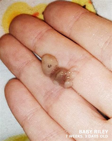 Live Action - These profound photos of babies tragically... | Facebook