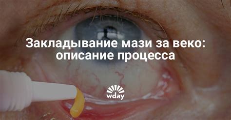 Как закладывать мазь за веко | WDAY