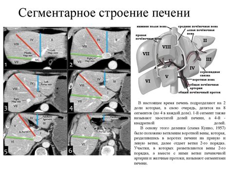 Нормальная лучевая анатомия желудочно-кишечного тракта - презентация онлайн