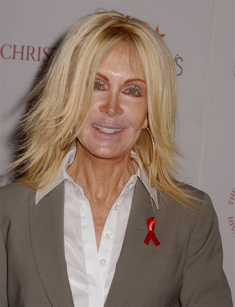 Fans Regret Joan Van Ark's Decision to Use Plastic Surgery – Her