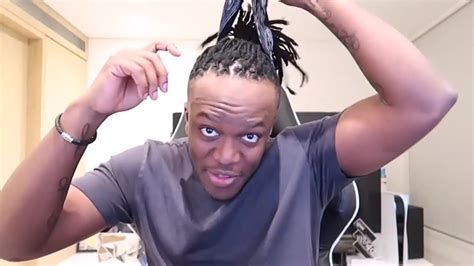 KSI Forehead: The Iconic Feature Of A YouTube Sensation