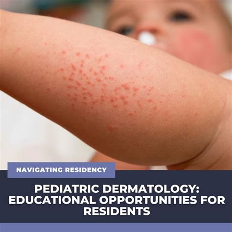 dermatology education resources archives  steps  dermatology