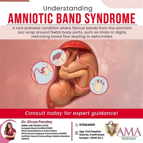 Amniotic Band Syndrome... - Dr. Divya's - Vama Diagnostics