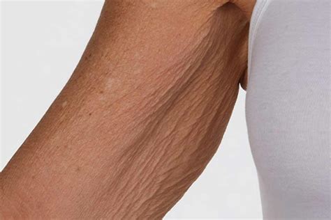 lotion  crepey skin  arms  legs  sheila tejada blog
