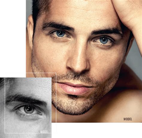 male blepharoplasty leyngold institute  plastic surgery