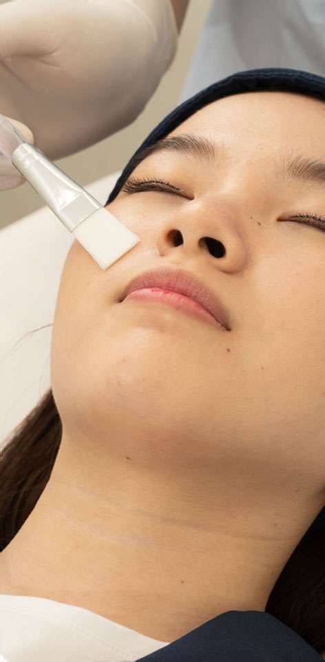 derma peel chemical peeling wajah  kulit lembut cerah