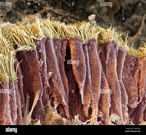 Lung lining. Coloured scanning electron micrograph (SEM) of a section ...
