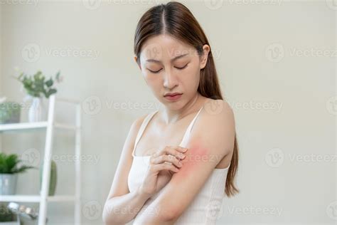 Dermatology, asian young woman, girl allergy, allergic reaction from