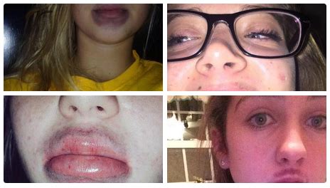When The Kylie Jenner Lip Transformation Challenge Goes Wrong. Epic Fails!