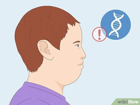 flat face   surgical surgical fixes