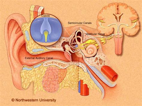 vestibular neuritis balance dizziness canada