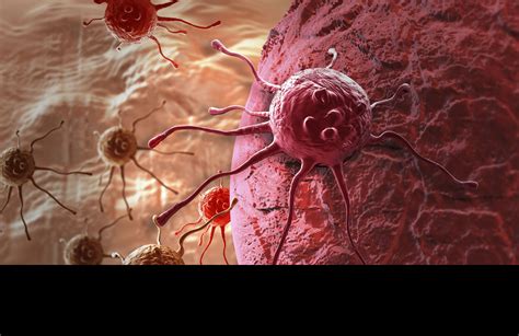 Malignant: Medical Definition, Tumors, and Conditions