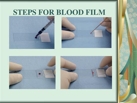 PPT - Blood smear preparation and staining PowerPoint Presentation ...