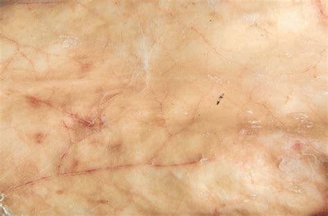 Ektoderm Bilder – Durchsuchen 827 Archivfotos, Vektorgrafiken und ...
