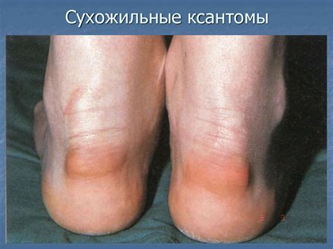 Дифференциальная диагностика высыпаний на лице - презентация онлайн