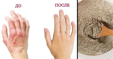 Бентонитовая глина: 10 способов оздоровить организм | Здоровье | Селдон ...