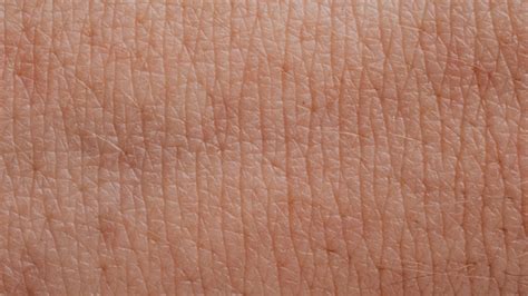 skin graft healing stages medical monks