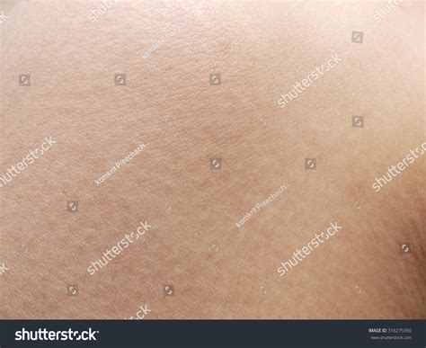 human skin knee texture stock photo  shutterstock