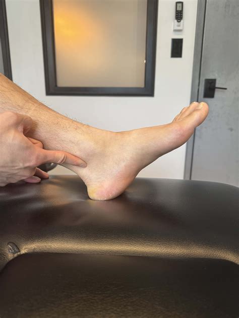 Physical Therapy for Posterior Tibial Tendon Dysfunction - The Game