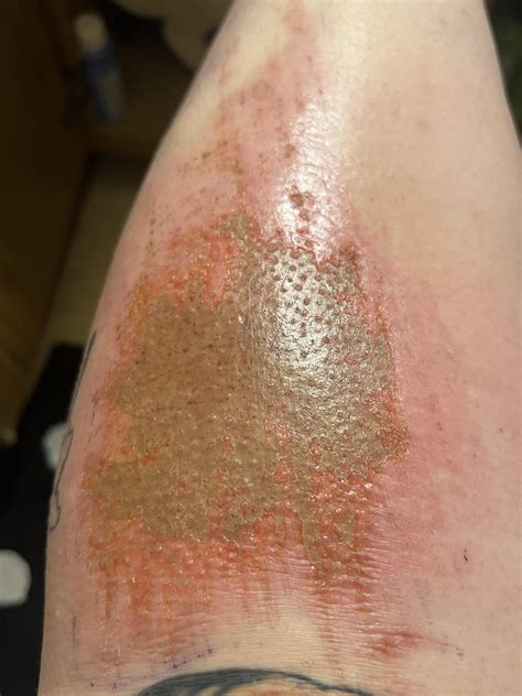 Kaitlyn Rose: The Leak And The Long Road To Healing. Image 11