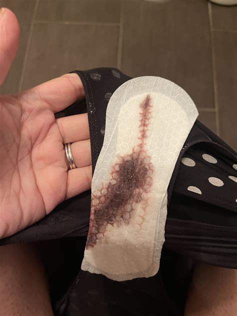 5 Months Pregnant Spotting