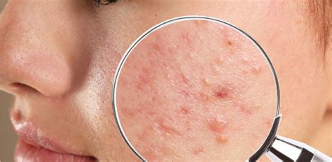 general dermatology healthcert education