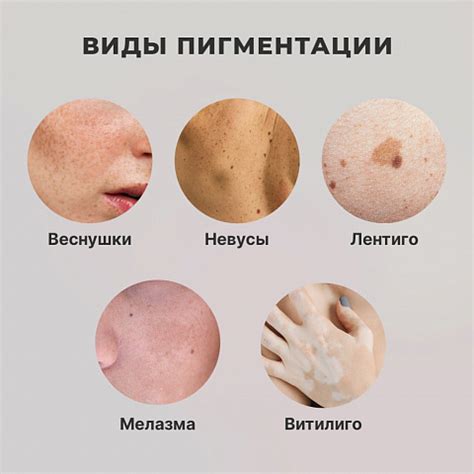 Пигментация Кожи На Лице Фото — New-Freepik.Ru
