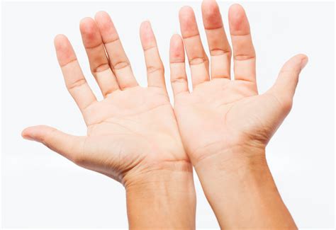 8 Signs to Look Out For in Hand Pain and Problems : The Hearty Soul 