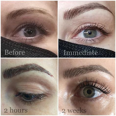Souirensu It Works: My Before & After Will Blow You Away! Image 18