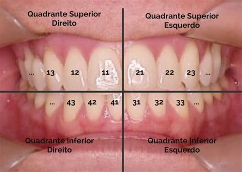 Nome Dos Dentes Da Boca - 8