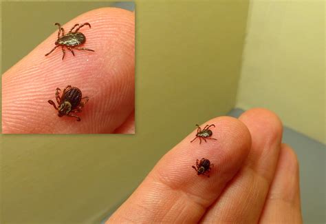 clinical image  tick species  shown