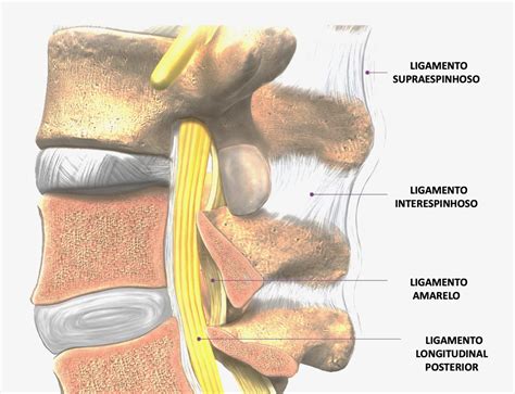 Qual A Função Dos Ligamentos - Edema Dos Ligamentos Interespinhosos - RETOEDU