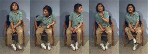 Chorea causes, types of chorea, symptoms, diagnosis & chorea treatment
