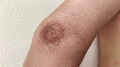 dark skin arm royalty  images stock  pictures shutterstock